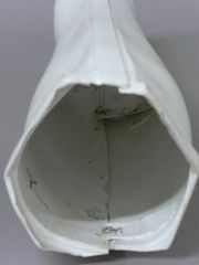 ANHinteriorlowerlegseamclosuresyste.jpg