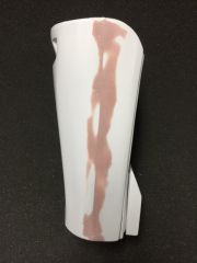 TK Echo Left Forearm 03